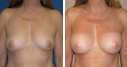 Before & After Photos